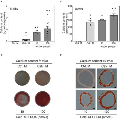 Stressor-Induced “Inflammaging” of Vascular Smooth Muscle Cells via Nlrp3-Mediated Pro-inflammatory Auto-Loop